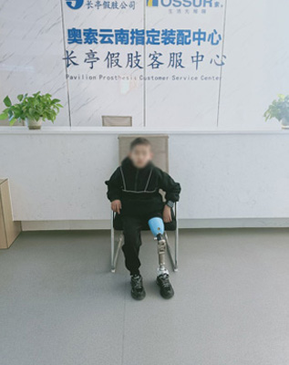 小孩大腿假肢